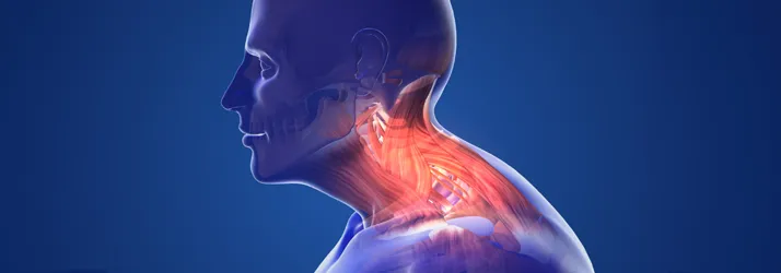 Chiropractic Rock Hill SC Fixing Your Neck Hump